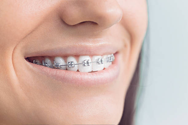 Best Traditional Braces  in Arnold, MO